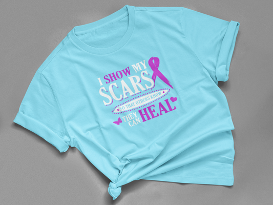 I Show My Scars So That Others Know They Can Heal